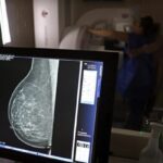 Ministério da Saúde recomenda mamografia pelo SUS para mulheres a partir dos 40 anos