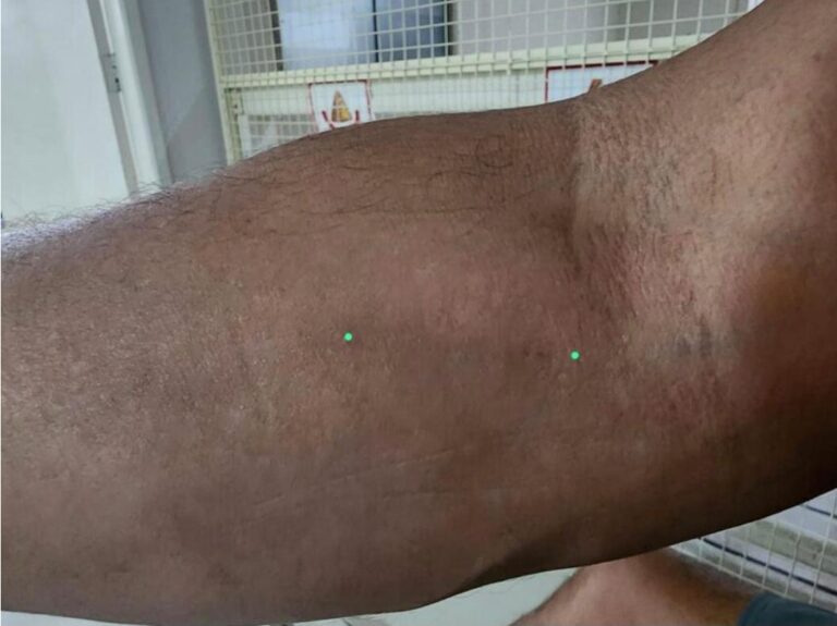 Denúncia aponta falhas em atendimento e divergência de diagnóstico no HGR